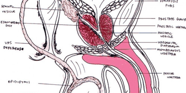prostatitis a férfiakban amelyek